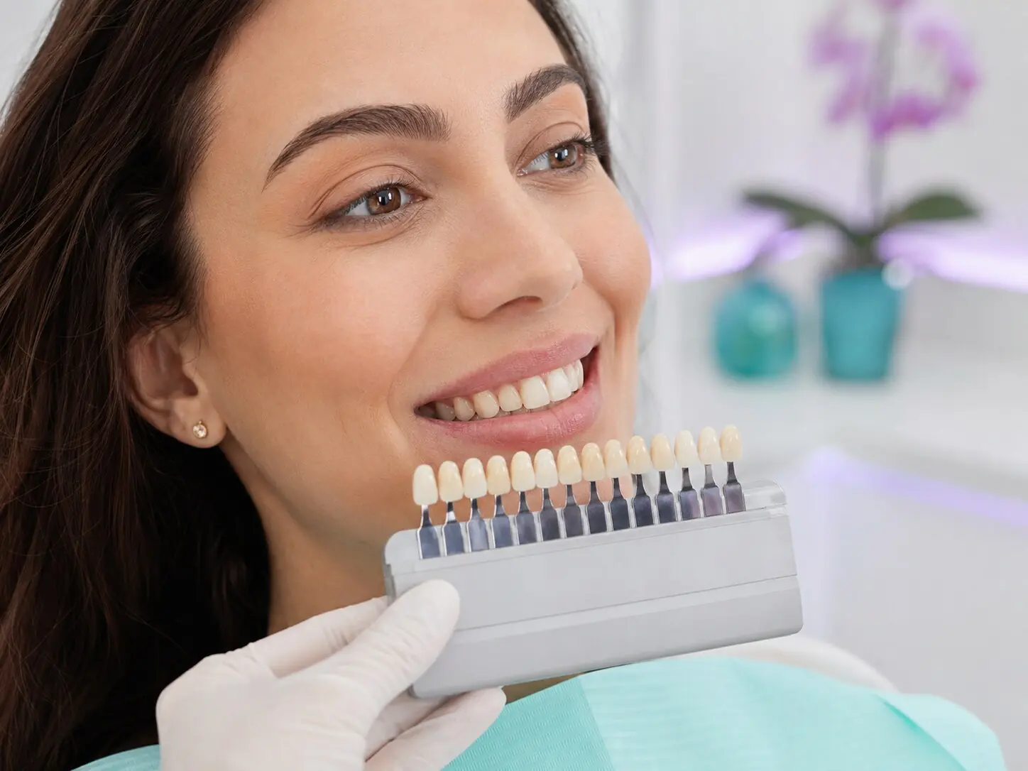 Planejamento estético de lentes de contato dental com escala de tonalidades
