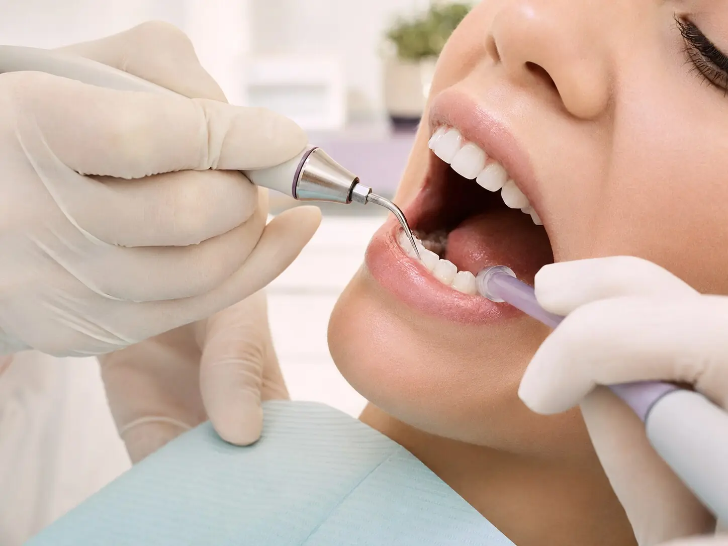 Procedimento profissional de profilaxia odontológica